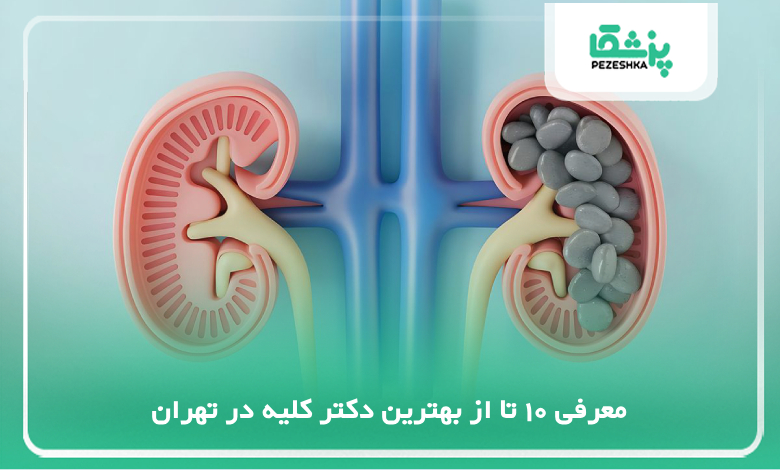 بهترین دکتر کلیه در تهران