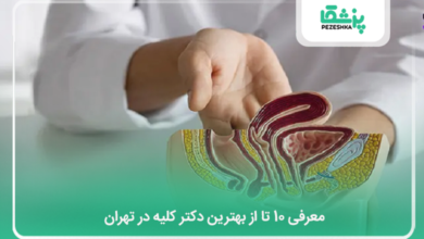 بهترین دکتر کلیه در تهران