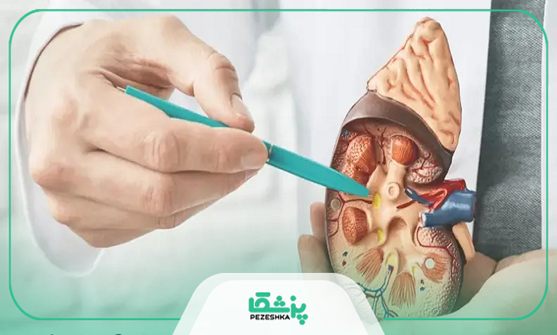 روشهای درمانی پیشرفته توسط پزشک کلیه تهران