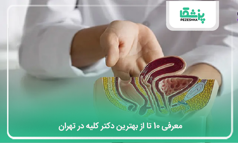 بهترین دکتر کلیه در تهران