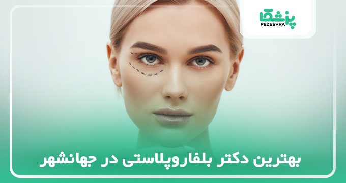 بهترین دکتر بلفاروپلاستی در جهانشهر