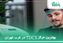 بهترین مرکز TDCS در غرب تهران