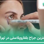 10 تا از بهترین جراح بلفاروپلاستی در تهران【سال1404】✅