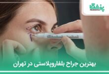 بهترین جراح بلفاروپلاستی در تهران