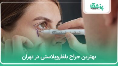 بهترین جراح بلفاروپلاستی در تهران
