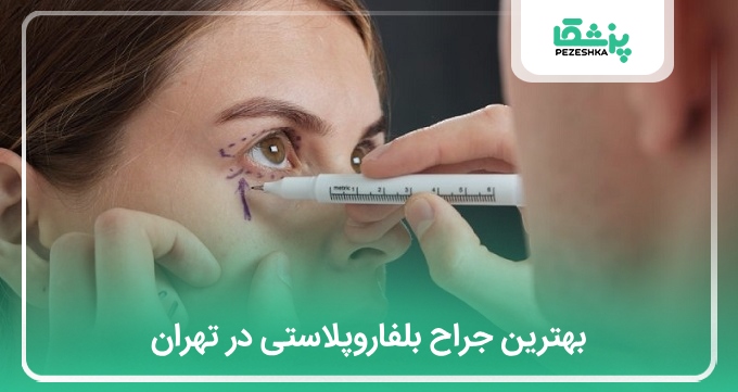 بهترین جراح بلفاروپلاستی در تهران