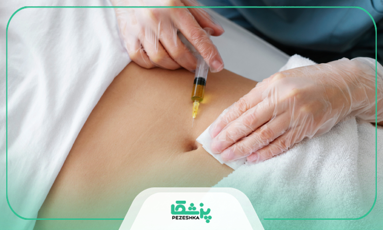 بهترین برند فیلر بادی کدام است؟