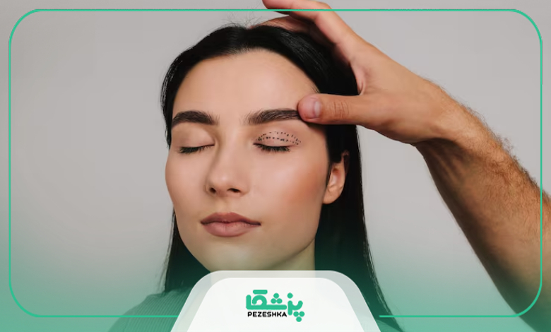 چگونه بهترین دکتر بلفاروپلاستی در جهانشهر را انتخاب کنیم؟