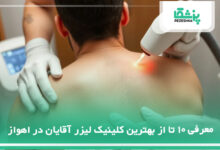 بهترین مرکز لیزر آقایان در اهواز