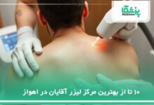 بهترین مرکز لیزر آقایان در اهواز