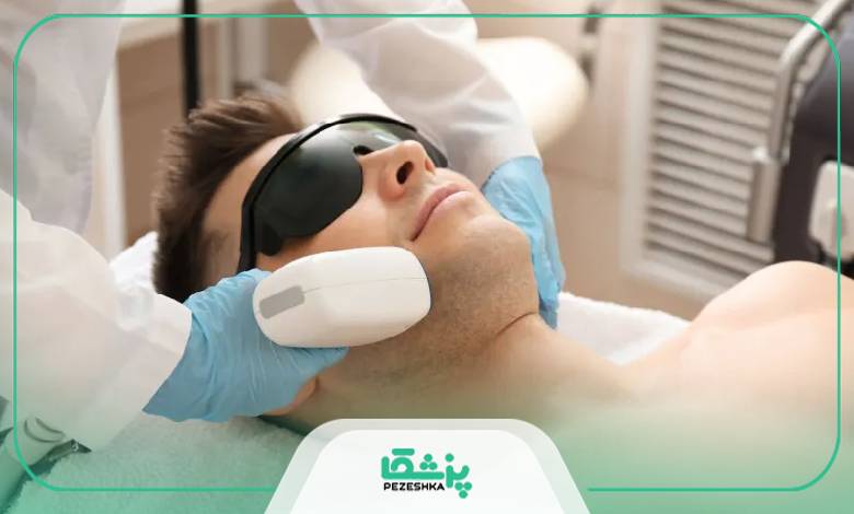 جدیدترین تکنولوژی لیزر موهای زائد آقایان در مشهد