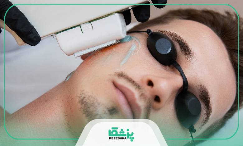 اقدامات مهم قبل و بعد از لیزر آقایان