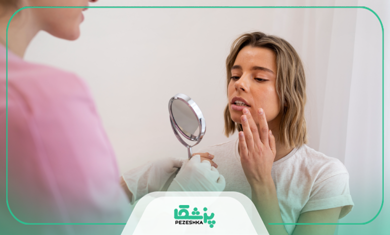 مزایای تزریق ژل لب برای اصلاح فرم لب