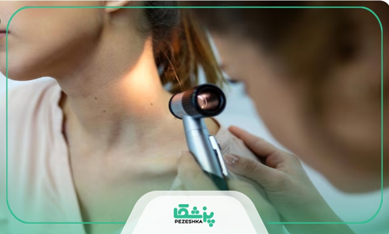 هزینه برداشتن خال در بهترین مرکز برداشتن خال در جردن