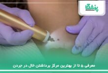 بهترین مرکز برداشتن خال در جردن