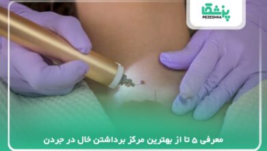 بهترین مرکز برداشتن خال در جردن