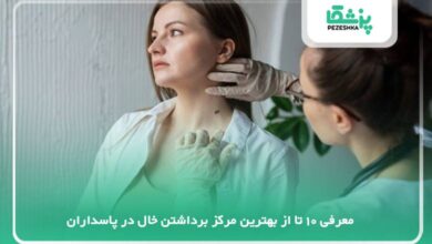 بهترین مرکز برداشتن خال در پاسداران