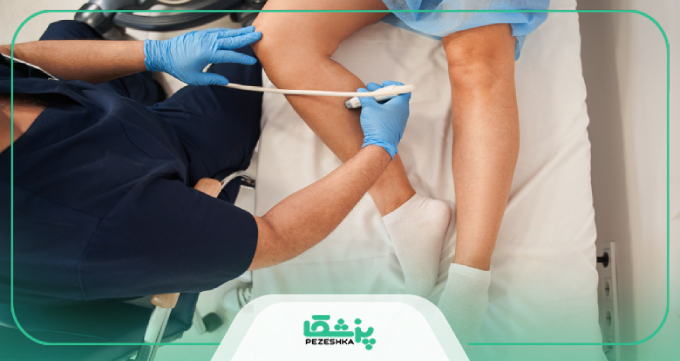 علائم واریس پا و زمان مراجعه به بهترین دکتر