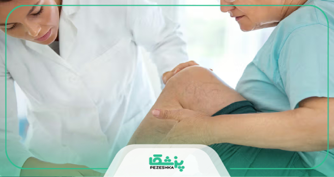 مراقبتهای قبل و بعد از درمان واریس در کرج