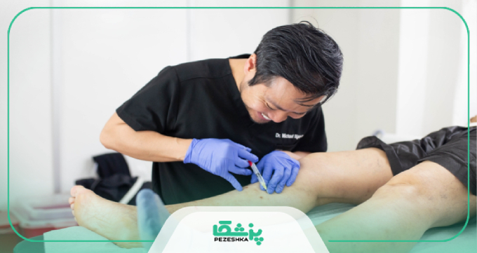 راهنمای انتخاب بهترین دکتر واریس پا در تهران