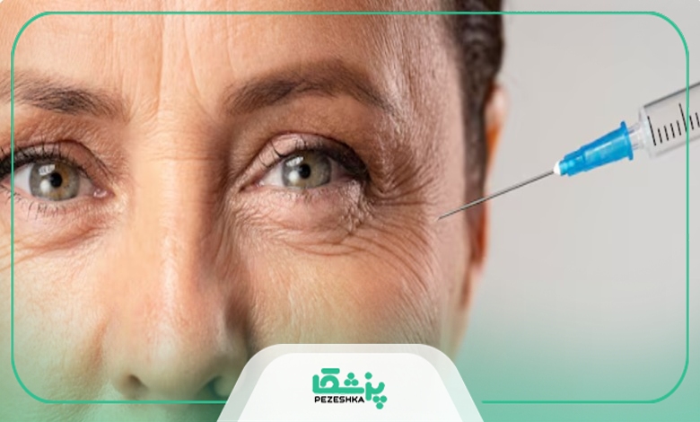 معیارهای انتخاب بهترین دکتر بوتاکس در شمال تهران