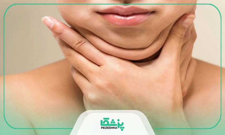 معیارهای انتخاب بهترین دکتر ساکشن غبغب در چیتگر