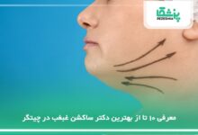 بهترین دکتر ساکشن غبغب در چیتگر