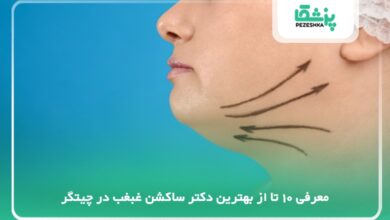 بهترین دکتر ساکشن غبغب در چیتگر