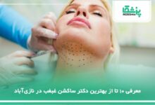 بهترین دکتر ساکشن غبغب در نازی‌آباد