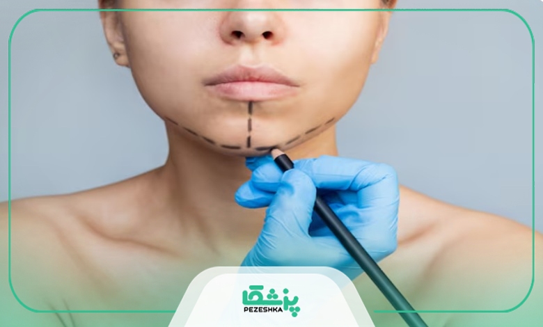 راهنمای انتخاب بهترین دکتر ساکشن غبغب در تهرانسر