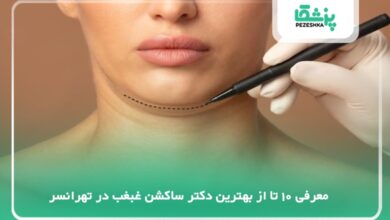 بهترین دکتر ساکشن غبغب در تهرانسر