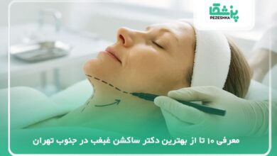 بهترین دکتر ساکشن غبغب در جنوب تهران
