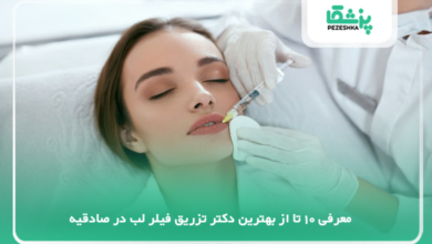 بهترین دکتر تزریق فیلر لب در صادقیه