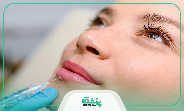 تمام نکات مهم بعد از تزریق فیلر لب که باید بدانید