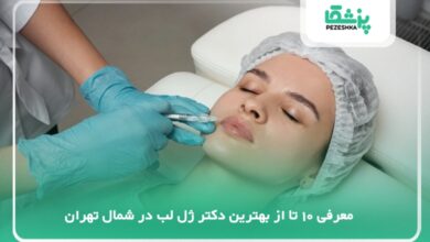 بهترین دکتر ژل لب در شمال تهران