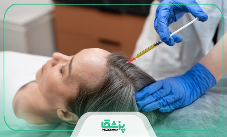 راهنمای انتخاب بهترین دکتر مزوتراپی در شمال تهران