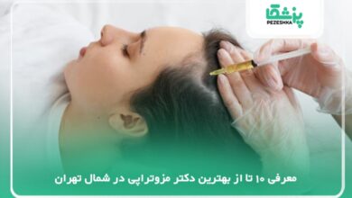 بهترین دکتر مزوتراپی در شمال تهران