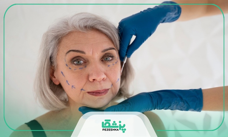 معیارهای انتخاب بهترین کلینیک لیفت با نخ در تهران