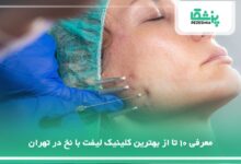 بهترین کلینیک لیفت با نخ در تهران