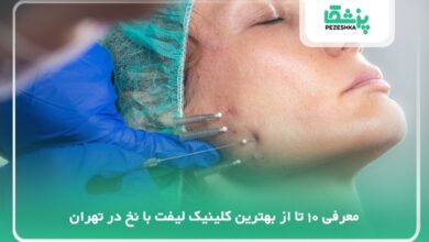 بهترین کلینیک لیفت با نخ در تهران