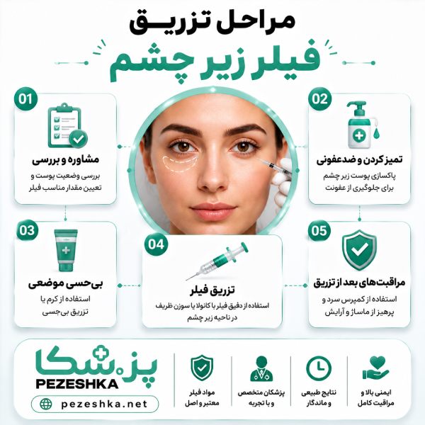 مراحق تزریق فیلر زیر چشم