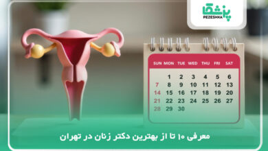 بهترین دکتر زنان در تهران