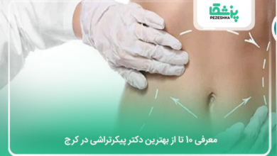 بهترین دکتر پیکرتراشی در کرج