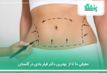 بهترین دکتر فیلر بادی در گلستان