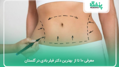 بهترین دکتر فیلر بادی در گلستان
