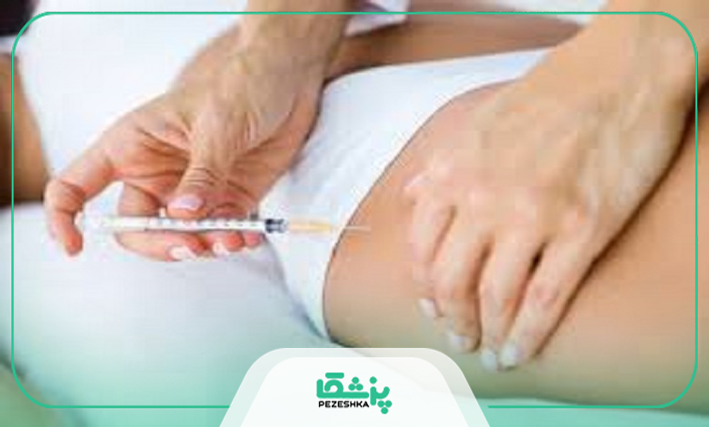 مزایای انجام فیلر بادی