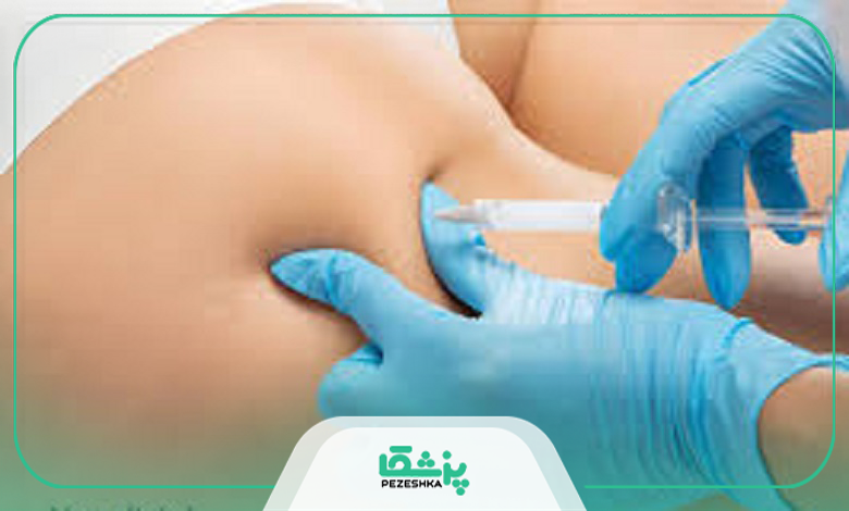 چه کسانی برای تزریق فیلر بادی مناسب هستند؟
