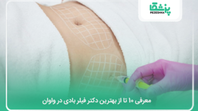 بهترین دکتر فیلر بادی در واوان