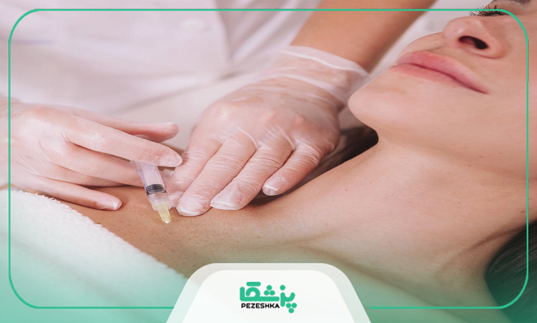 محبوبترین نوع فیلرهای بادی