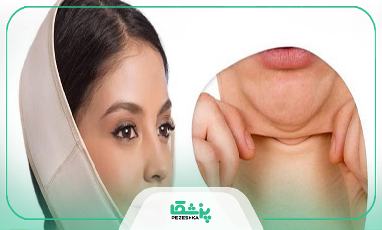راههای پیشگیری از بروز غبغب